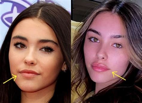 does madison beer have a boob job|Celebrities with Breast Implants 